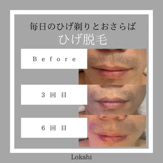 メンズ Lokahi所属・リラク/エステ Lokahiのエステ・リラクイメージ