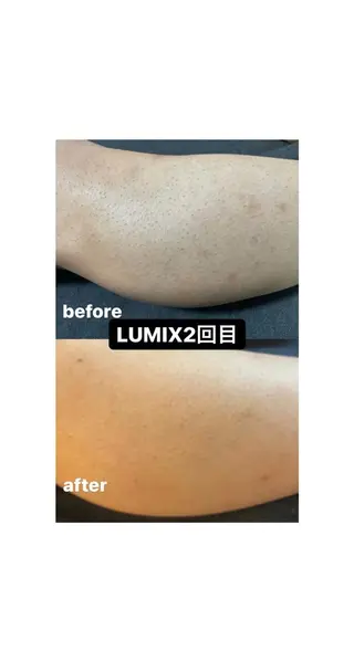 メンズ Epina 千葉店 【エピナ】のエステ・リラクイメージ