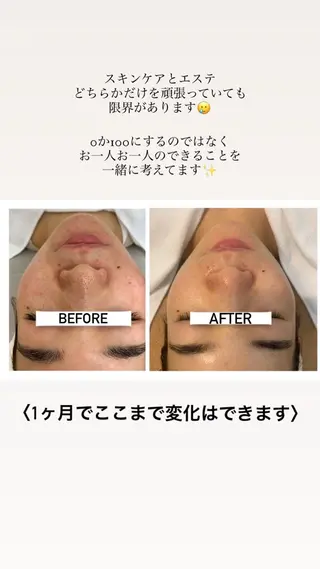 ナリスビューティサロンあべの所属・肌質改善/ツヤ肌作り /松本杏奈のエステ・リラクイメージ