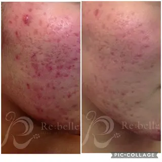 Lavi&所属・肌質改善サロン Lavi&のその他イメージ