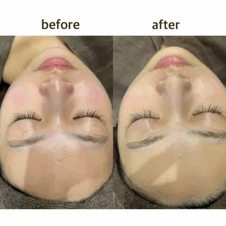 田辺🌿毛穴ケア サロンリテルナのエステ・リラクイメージ