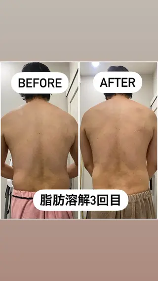 アルカンジュ~archange~所属・痩身/毛穴洗浄/脱毛 アルカンジュのエステ・リラクイメージ