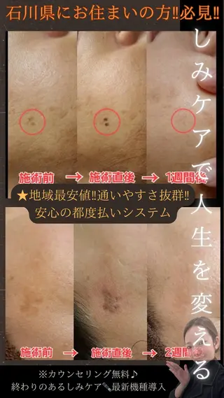 LiZA エステティックサロンのエステ・リラクイメージ