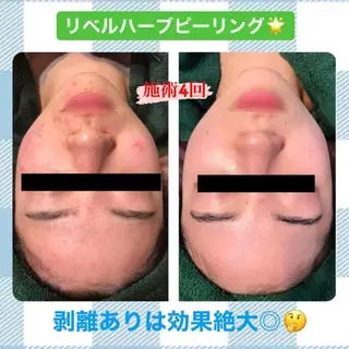 ハーブピーリング専門店HERBERRY難波心斎橋店所属・ハーブピーリング専門 HERBERRY冨永のエステ・リラクイメージ