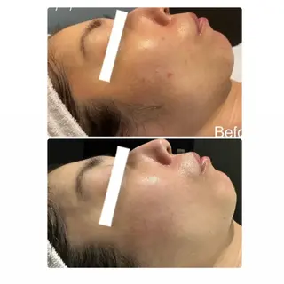 デ・アイム心斎橋所属・肌質改善サロン🫧 MAIのエステ・リラクイメージ