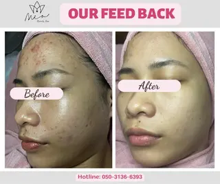 Mia beauty所属・MiA Beautyのエステ・リラクイメージ