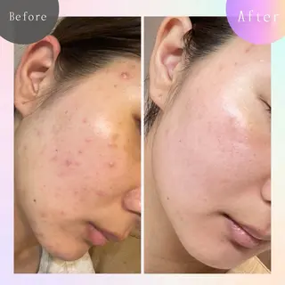 ニキビ改善専門店 d'Albaのエステ・リラクイメージ