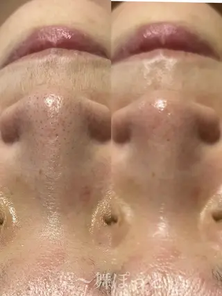 うえつま ふみえのエステ・リラクイメージ