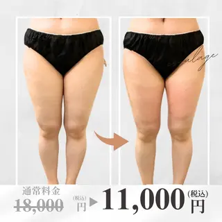 脂肪冷却フェイシャル エスラージュのエステ・リラクイメージ