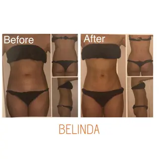 BELINDA銀座店 ✨痩身エステサロン✨のエステ・リラクイメージ