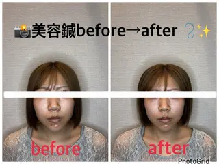 小林整骨院本町 美容鍼roomのエステ・リラクイメージ