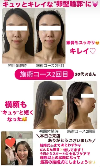 la lumie're (ラ リュミエール)所属・小顔サロン (ラ リュミエール)のエステ・リラクイメージ