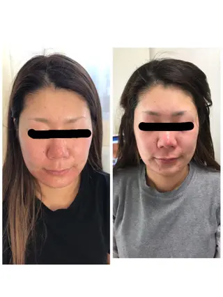 トータルエステサロン Tiaraのエステ・リラクイメージ