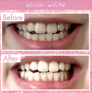 エクシアホワイト 💟fukaのその他イメージ