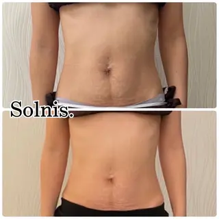 大阪市初！男性もok 酵素浴/痩身/小顔のその他イメージ