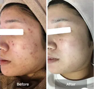 ハーブピーリング専門 COCO.梅田中津のエステ・リラクイメージ