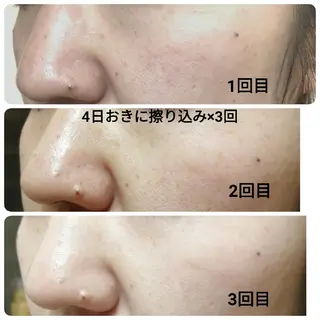 未病ケアサロン　EMINY所属・未病ケアサロン EMINY☺︎勝俣のエステ・リラクイメージ