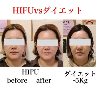 a  room salonのエステ・リラクイメージ