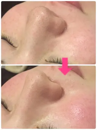 ロング カラー パーマ ヘアアレンジ メンズ キッズ ネイル マツエク・マツパ ‍痩身＆ボディ 結果出し🌟丹野のエステ・リラクイメージ