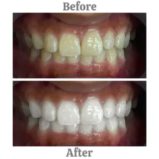 セルフホワイトニング　エクシア相模大野店所属・mo moのその他イメージ