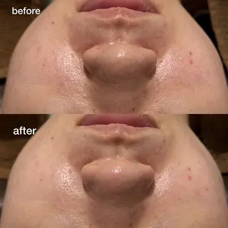 ENCHANT Kaede/肌質改善のその他イメージ