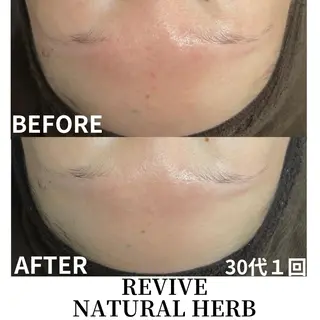 プレイス天王寺店 【肌質改善/ハーブ】のエステ・リラクイメージ