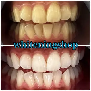 メンズ ホワイトニング ショップ川越店のエステ・リラクイメージ