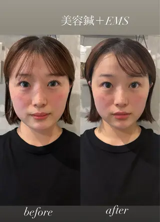 美容鍼灸サロン mahoroba院長のエステ・リラクイメージ