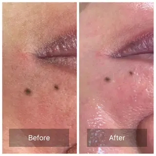 産毛専門店 Bittoのエステ・リラクイメージ