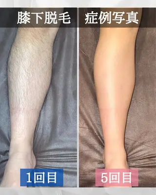 メンズ MEN'S SALON glow所属・メンズ脱毛 glow 中目黒のエステ・リラクイメージ