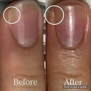 ネイル 深爪・自爪育成専門 MAHALOHIのネイルデザイン