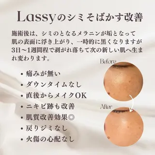 Lassy Yuriの眉毛・アイブロウイメージ