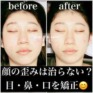 🌈歪み改善🌈 バリンタイ すぎうらのエステ・リラクイメージ