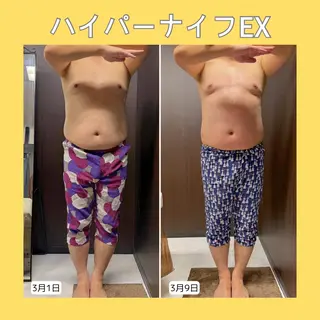 赤澤/本気痩せ・脱毛 ・ノーファンデ肌のその他イメージ