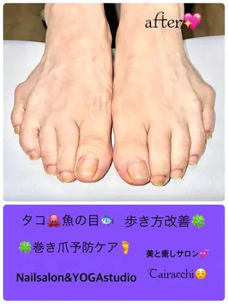ネイル Tairacchi ﾀｲﾗｯﾁのエステ・リラクイメージ