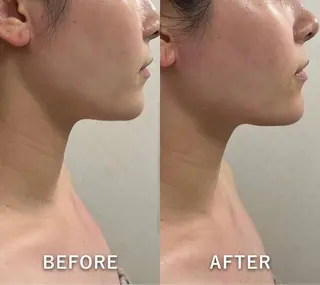 韓国美肌/肌質改善 【天神】yuiのエステ・リラクイメージ