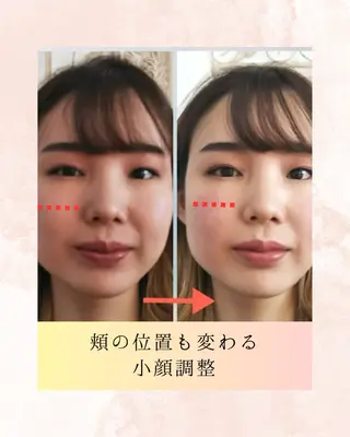 山嵜 まりこのエステ・リラクイメージ