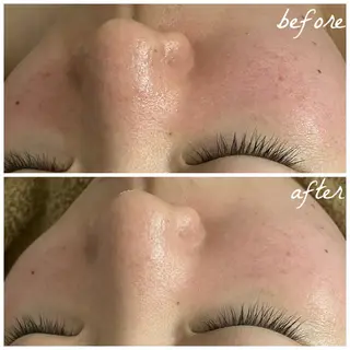 メンズ メナード岐阜市茜部 杉浦のエステ・リラクイメージ