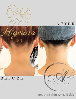 BeautysalonA所属・うなじ脱毛/ つや肌ハーブのエステ・リラクイメージ