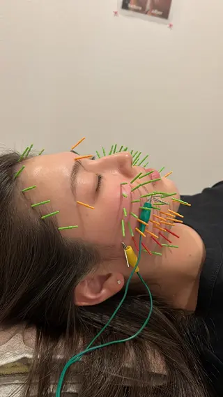 美容鍼灸Solana所属・肌質改善×美容鍼 ゆいのエステ・リラクイメージ