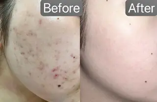 韓国肌管理Belle堀江所属・韓国肌管理 Belle堀江のエステ・リラクイメージ