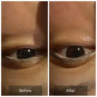 Mandarin Orange所属・毛穴から始める肌メン テマンダリンオレンジのエステ・リラクイメージ