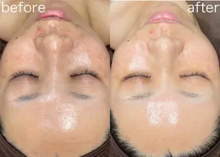 医療提携Beauty SalonMuseのエステ・リラクイメージ