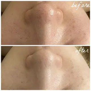 メンズ メナード岐阜茜部 杉浦のエステ・リラクイメージ