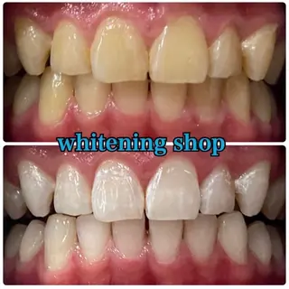 ホワイトニング ショップ吉祥寺店のエステ・リラクイメージ