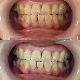 西宮ホワイトニング Kirarie所属・志水 有美のエステ・リラクイメージ