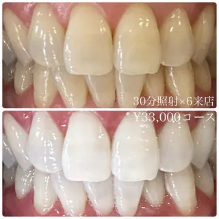 PLATINUM Beauty 横浜店所属・ホワイトニングルーム 横浜店のその他イメージ