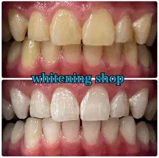 ホワイトニング ショップ吉祥寺店のエステ・リラクイメージ