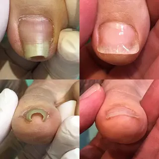 東京巻き爪アカデミー所属・東京巻き爪 アカデミーのエステ・リラクイメージ