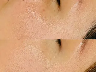 LukeBeauty salonのエステ・リラクイメージ